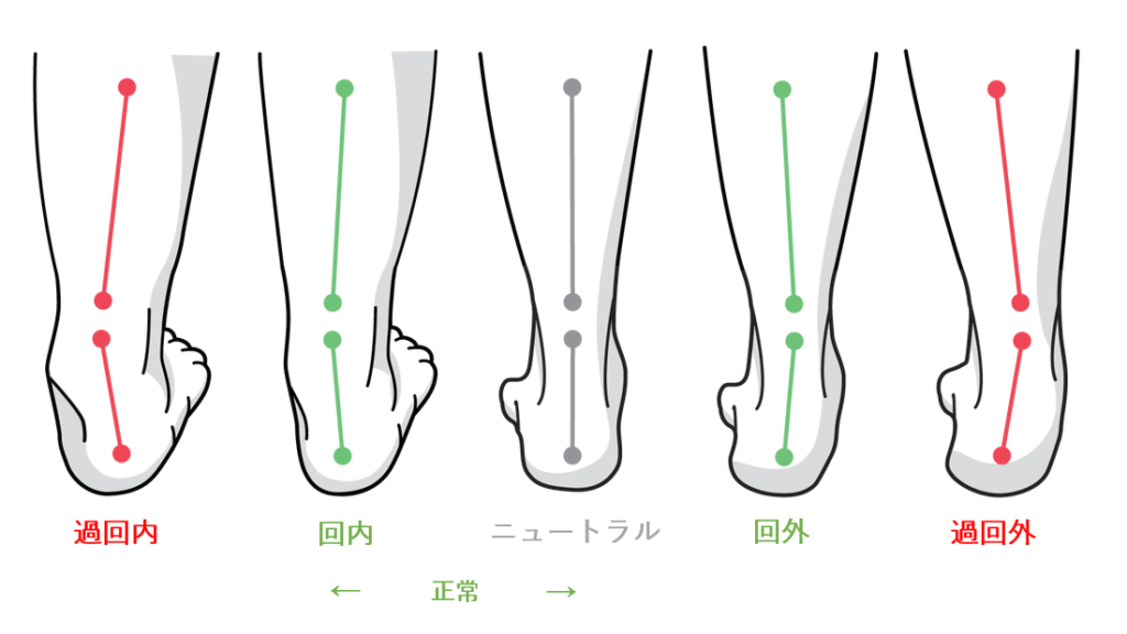 足ー回内