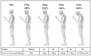 smartphones_neck_pressure_pain_dr_krystov_bock_active_quiropratica_chiropractor_algarve_quiropratico