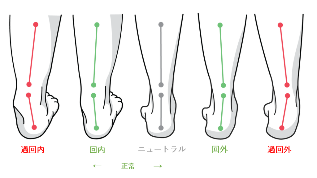 足ー回内